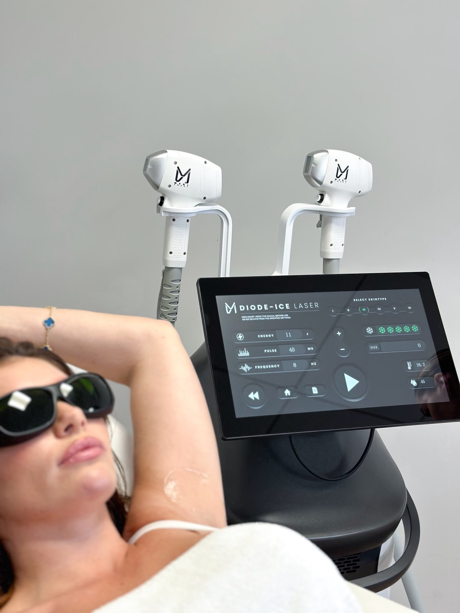 Diode Ice Laser behandeling